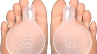 بقع القدم هيبوالرجينيك