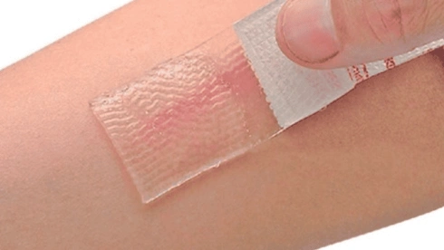 Kontaktdermatitis