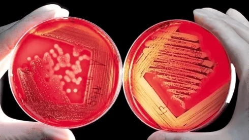 Plásticos antimicrobianos